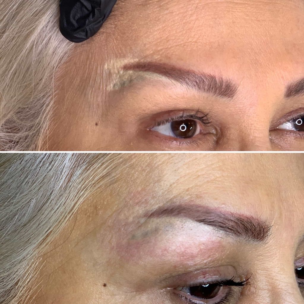 Bad Microblading with correction