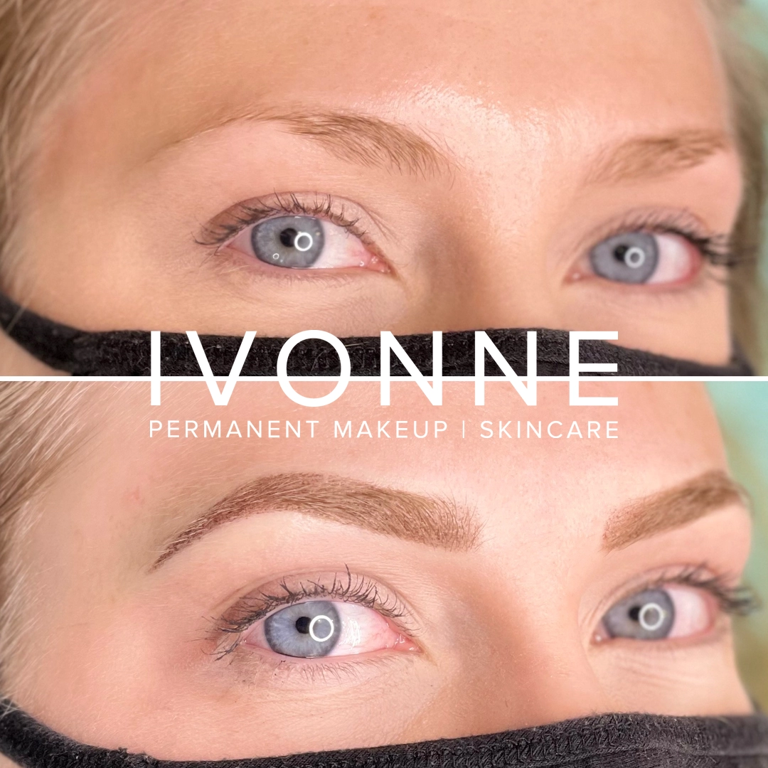 Before_After_IVONNE_7